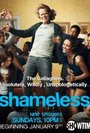 Shameless (US)
